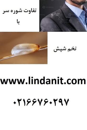 تفاوت تخم شپش با شوره سر ، فرق رشک و شپش تفاوت تخم شپش با شوره سر ، فرق رشک و شپش