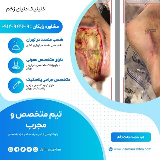 کلینیک زخم دنیای زخم کلینیک زخم دنیای زخم