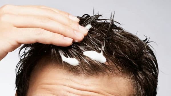 عوارض استفاده از موس مو عوارض استفاده از موس مو