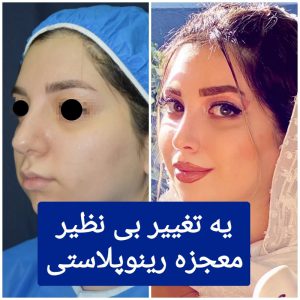 نمونه جراحی ها انجام شده دکتر رسول پناه نمونه جراحی ها انجام شده دکتر رسول پناه
