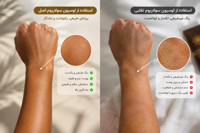 راهنمای جامع خرید لوسیون سولاریوم