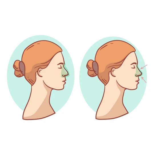 جراحی بینی جراحی بینی