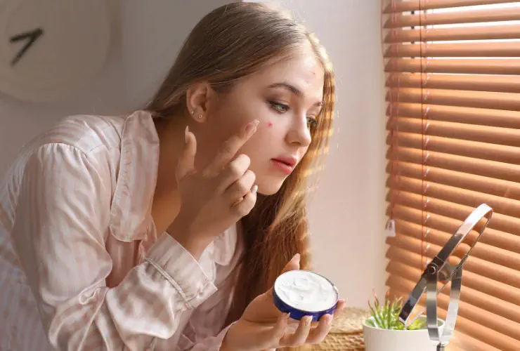 معرفی انواع محصولات برای درمان جای جوش صورت معرفی انواع محصولات برای درمان جای جوش صورت