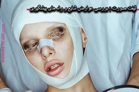 لیفت صورت : بررسی عوارض شایع و راه های پیشگیری لیفت صورت : بررسی عوارض شایع و راه های پیشگیری