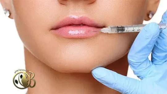 تزریق فیلر یا ژل لب تزریق فیلر یا ژل لب