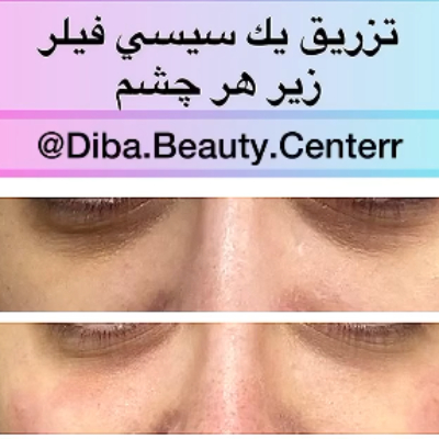 كلينيك زيبايي ديبا كلينيك زيبايي ديبا