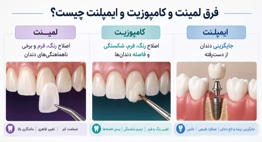 تفاوت لمینت و کامپوزیت و ایمپلنت چیست؟