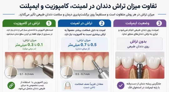تفاوت میزان تراش دندان در لمینت، کامپوزیت و ایمپلنت