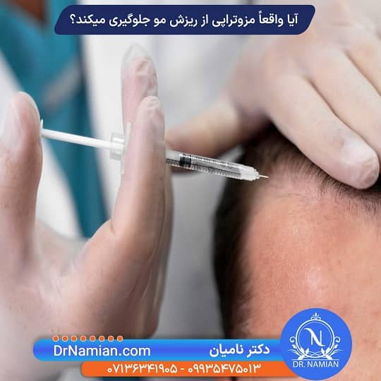 مزوتراپی مو در شیراز توسط دکتر نامیان مزوتراپی مو در شیراز توسط دکتر نامیان