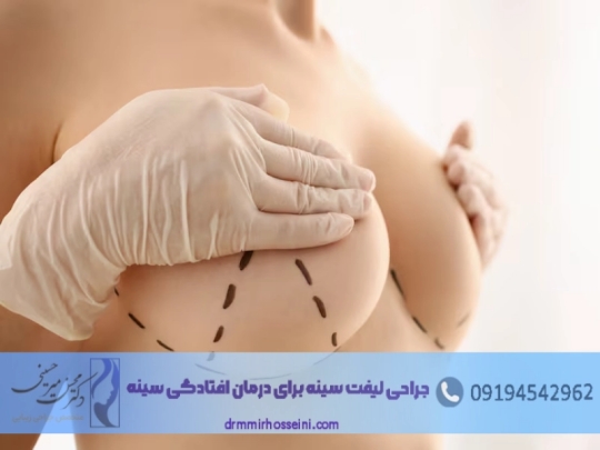 جراحی لیفت سینه جراحی لیفت سینه