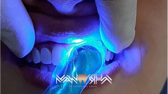 مشکلات رایج دندانی و راه حل های آنها با دکتر مانوشا امیری مشکلات رایج دندانی و راه حل های آنها با دکتر مانوشا امیری