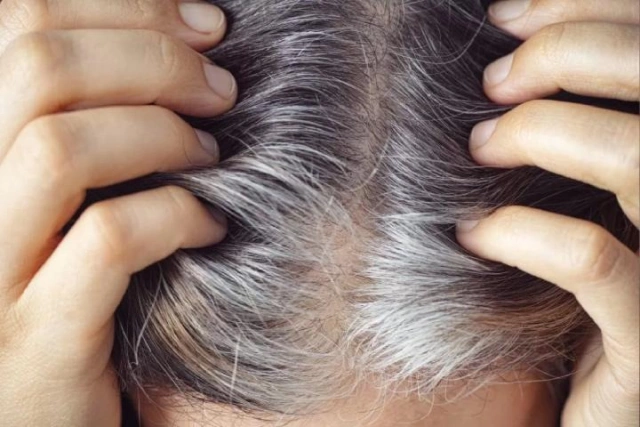 C:\Users\Asus\Dropbox\My PC (DESKTOP-5H0DOOG)\Downloads\plucking white hair\plucking white hair.2.jpg