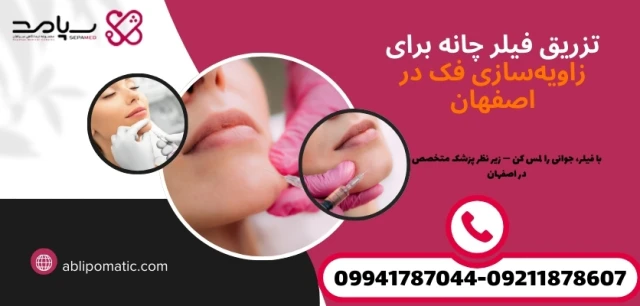 فیلر لب اصفهان فیلر لب اصفهان