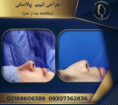 نمونه جراحی ها انجام شده دکتر میقانی نمونه جراحی ها انجام شده دکتر میقانی