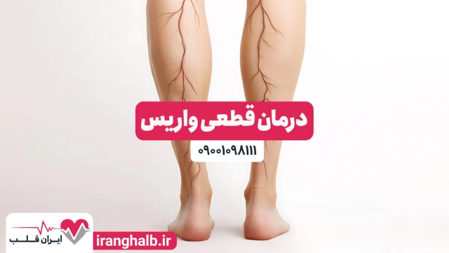 درمان قطعی واریس درمان قطعی واریس