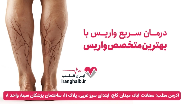 درمان سریع واریس درمان سریع واریس